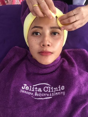 Pengalaman Treatment Perawatan Wajah di Jelita Clinic Bekasi